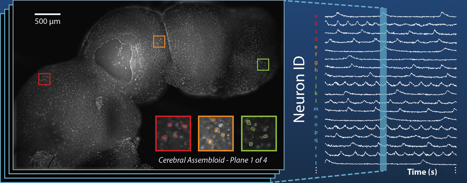 Défis de l'imagerie des modèles in vitro ; Partie 1 : Champ de vision
